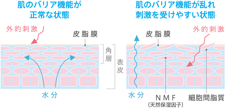 バリア機能が正常な肌とバリア機能が低下した肌
