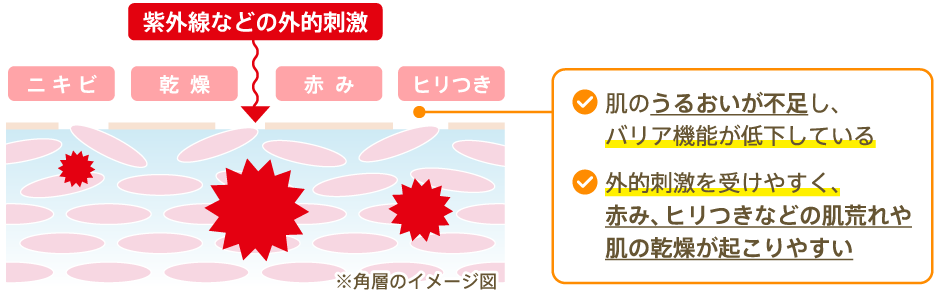 肌のうるおいが不足し、バリア機能が低下している／外的刺激を受けやすく、赤み、ヒリつきなどの肌荒れや肌の乾燥が起こりやすい