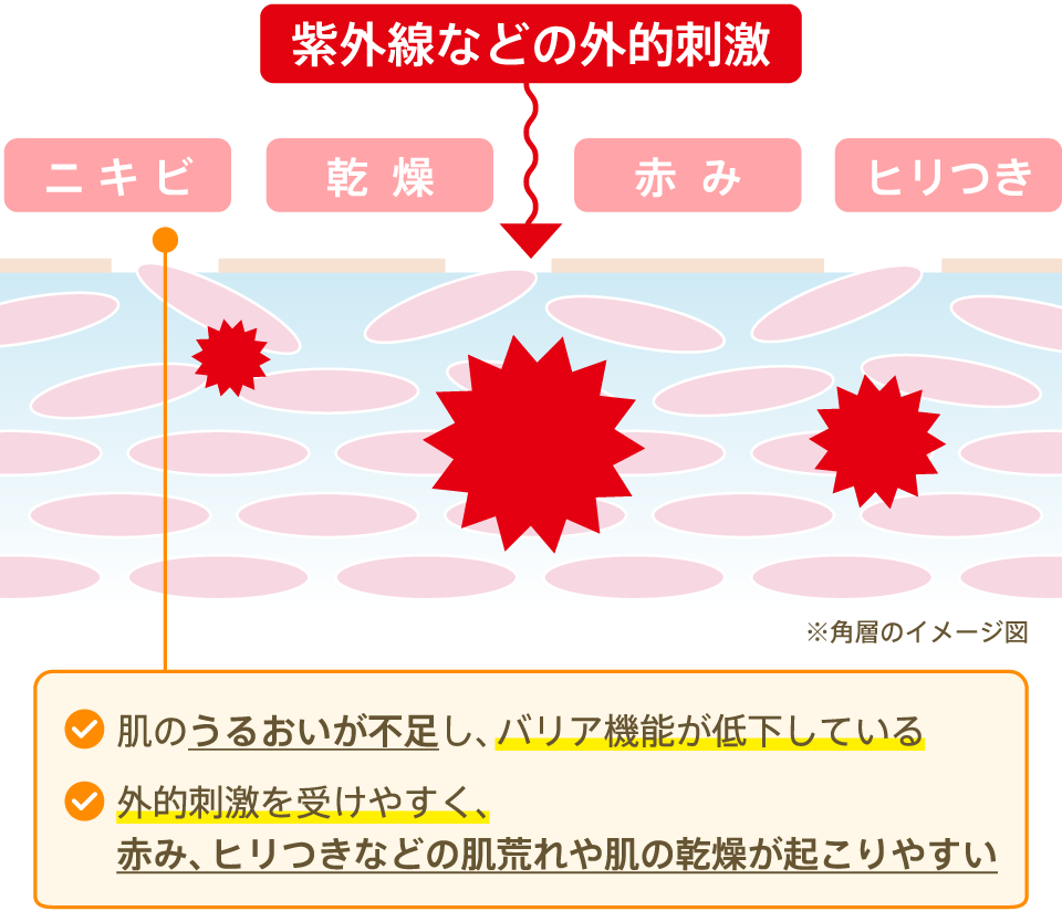 肌のうるおいが不足し、バリア機能が低下している／外的刺激を受けやすく、赤み、ヒリつきなどの肌荒れや肌の乾燥が起こりやすい